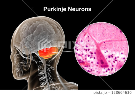 Human brain with highlighted cerebellum and close-up of Purkinje neurons, 3D illustration and light micrograph. 128664630