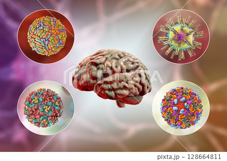 Microorganisms that cause brain infections 128664811