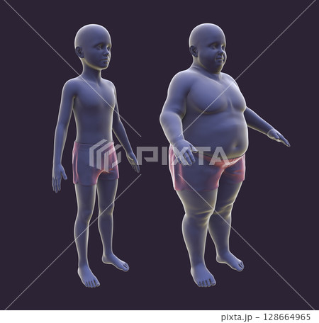 Obese boy before and after gaining weight, 3D illustration. Concept of obesity 128664965