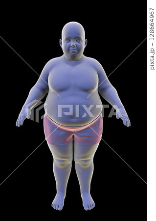 Obese boy, 3D illustration. Concept of obesity Obese boy, 3D illustration. Concept of obesity 128664967