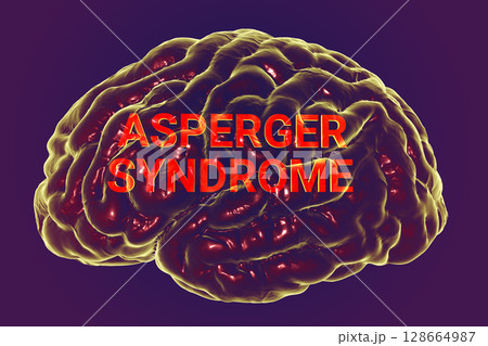 A conceptual 3D illustration featuring the text Asperger Syndrome inside the anatomical model of a human brain, highlighting the neurological basis of the condition 128664987