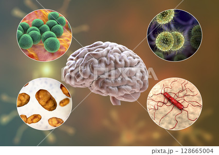 Etiology of bacterial meningitis 128665004