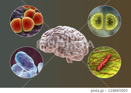 Etiology of bacterial meningitis Etiology of bacterial meningitis 128665005