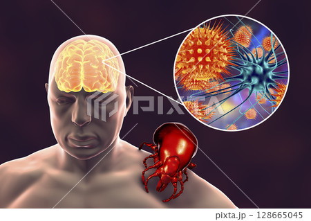 Tick-borne encephalitis concept 128665045