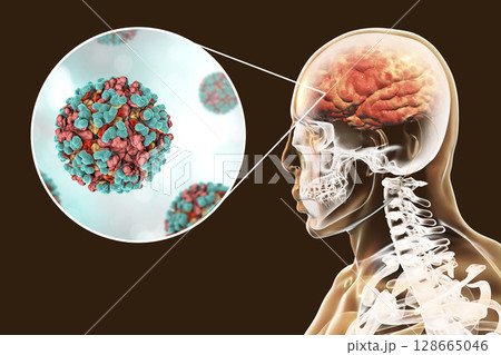 Venezuelan equine encephalitis, medical concept 128665046