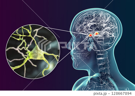Amygdala in the brain, and closeup view of amygdala neurons, 3D illustration Amygdala in the brain, and closeup view of amygdala neurons, 3D illustration 128667894