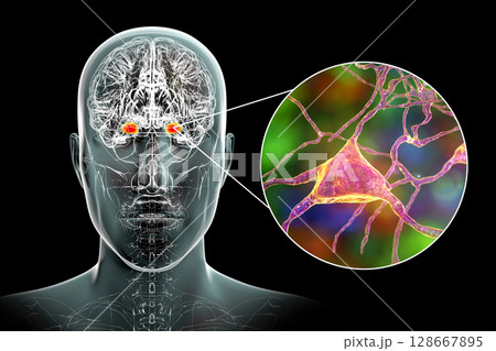 Amygdala in the brain, and closeup view of amygdala neurons, 3D illustration Amygdala in the brain, and closeup view of amygdala neurons, 3D illustration 128667895
