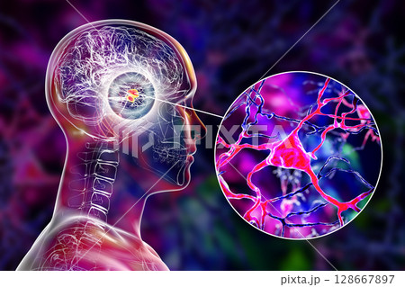 Amygdala in the brain, and closeup view of amygdala neurons, 3D illustration 128667897