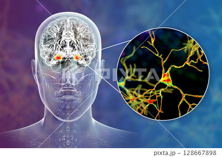 Amygdala in the brain, and closeup view of amygdala neurons, 3D illustration Amygdala in the brain, and closeup view of amygdala neurons, 3D illustration 128667898
