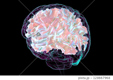 Human brain with highlighted white matter, 3D illustration Human brain with highlighted white matter, 3D illustration 128667968