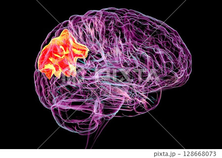 Human brain with highlighted precuneus gyrus, 3D illustration 128668073
