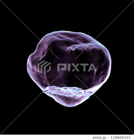 Patella fracture Patella fracture 128668101