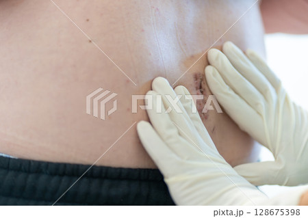 Medical Professional Examines Surgical Site on 128675398