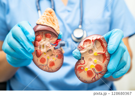 Chronic kidney disease, doctor with model for treatment urinary system, urology, Estimated glomerular filtration rate eGFR. Chronic kidney disease, doctor with model for treatment urinary system, urology, Estimated glomerular filtration rate eGFR. 128680367