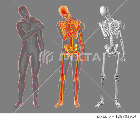 Shoulder pain, 3D illustration 128703914