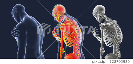 Shoulder pain, 3D illustration 128703920