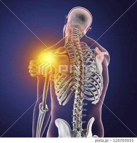 Shoulder pain, 3D illustration Shoulder pain, 3D illustration 128703933