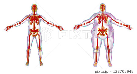 Obesity problem conceptual image 128703949