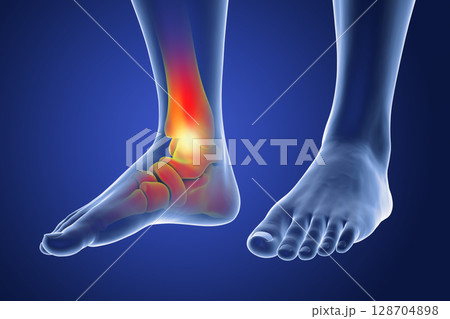 Foot and ankle pain, conceptual 3D illustration Foot and ankle pain, conceptual 3D illustration 128704898