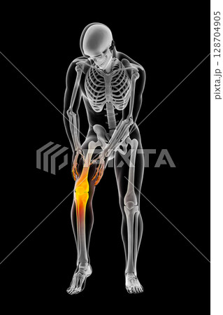 Painful knee, anatomy and medicine concept Painful knee, anatomy and medicine concept 128704905