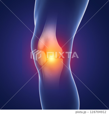 Painful knee, close-up view, anatomy and medicine concept Painful knee, close-up view, anatomy and medicine concept 128704912
