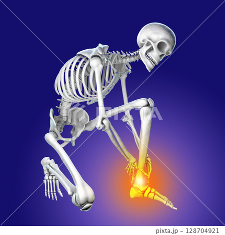 Foot and ankle pain, conceptual 3D illustration 128704921