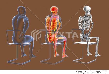 Human spine pain, backache, back pain Human spine pain, backache, back pain 128705002