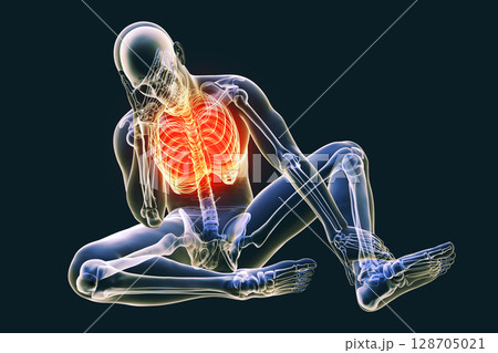 Male body in unhappy frustrated pose, conceptual 3D illustration Male body in unhappy frustrated pose, conceptual 3D illustration 128705021