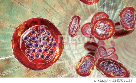 The malaria-infected red blood cells The malaria-infected red blood cells 128705117