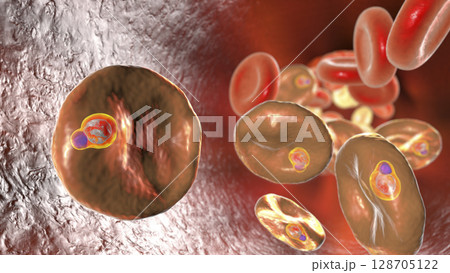 Babesia parasites inside red blood cell, the causative agent of babesiosis Babesia parasites inside red blood cell, the causative agent of babesiosis 128705122