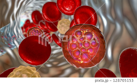Red blood cell infected with malaria parasite Plasmodium vivax, schizont stage Red blood cell infected with malaria parasite Plasmodium vivax, schizont stage 128705153