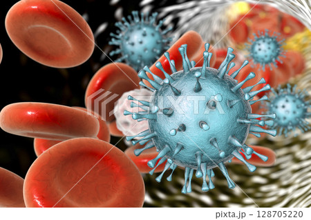 Cytomegalovirus in blood Cytomegalovirus in blood 128705220