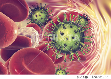 Cytomegalovirus in blood 128705222