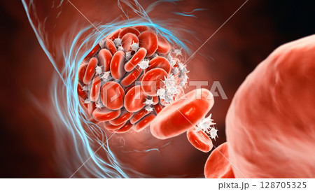 Blood clot made of red blood cells, platelets and fibrin protein strands Blood clot made of red blood cells, platelets and fibrin protein strands 128705325