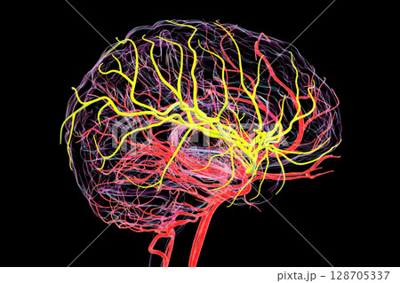 Brain arteries with highlighted middle cerebral artery in yellow, 3D illustration Brain arteries with highlighted middle cerebral artery in yellow, 3D illustration 128705337