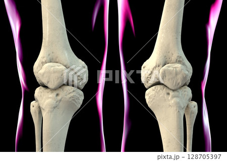 Knee bones anatomy, 3D illustration 128705397