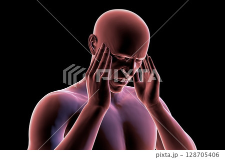Headache, 3D illustration 128705406