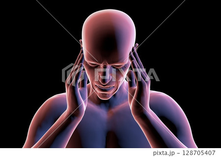 Headache, 3D illustration 128705407