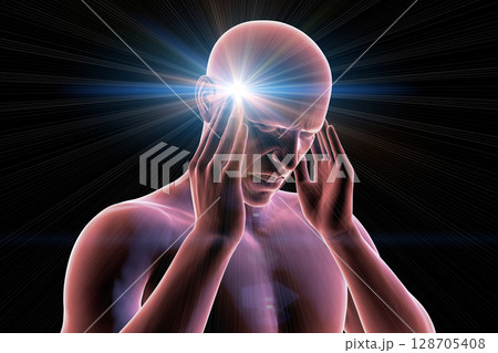 Headache, 3D illustration 128705408