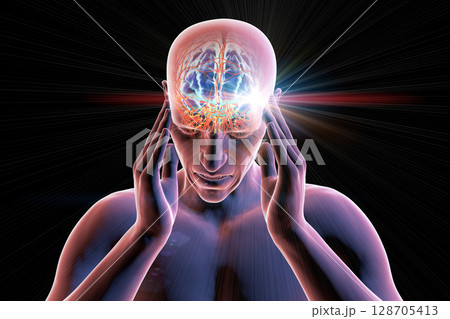 Headache, 3D illustration Headache, 3D illustration 128705413