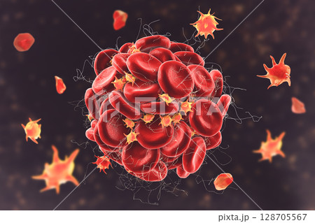 Blood clot made of red blood cells, platelets and fibrin protein strands. Thrombus 128705567