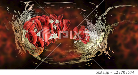 Blood clot, 360 degree panorama view 128705574
