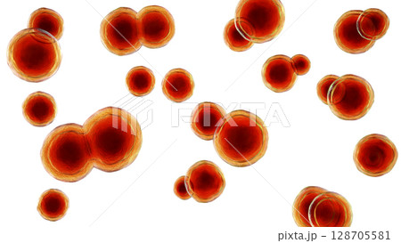 Blastomyces dermatitidis fungi 128705581