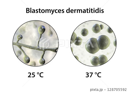 Blastomyces dermatitidis fungi 128705592