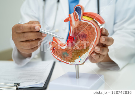 Stomach disease, doctor holding anatomy model for study diagnosis and treatment in hospital. Stomach disease, doctor holding anatomy model for study diagnosis and treatment in hospital. 128742836
