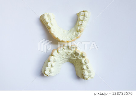 型取りした歯の模型②,Impression of teeth model 型取りした歯の模型②,Impression of teeth model 128753576