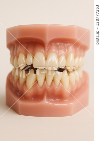 歯列矯正 歯並びがガタガタしている歯の模型 歯列矯正 歯並びがガタガタしている歯の模型 128777263