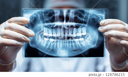 Close up view of a dental X ray image held by hands in medical gloves with blurred clinic background 128786215