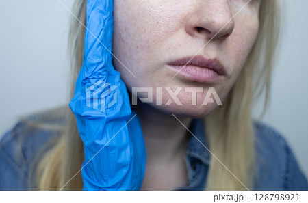 A dermatologist examines a woman's face with dilated pores, pigmentation, and sebaceous filaments. Treatment of rosacea and skin inflammation. 128798921