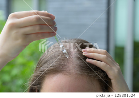 Close up of a woman applying serum to dry irritated and itchy scalp with a glass dropper. Concept of skincare, scalp treatment, hydration, self care and hair health with focus on roots and moisture. Close up of a woman applying serum to dry irritated and itchy scalp with a glass dropper. Concept of skincare, scalp treatment, hydration, self care and hair health with focus on roots and moisture. 128801324